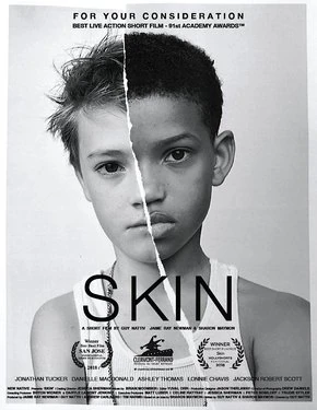 Arquivo:Skin.jpg