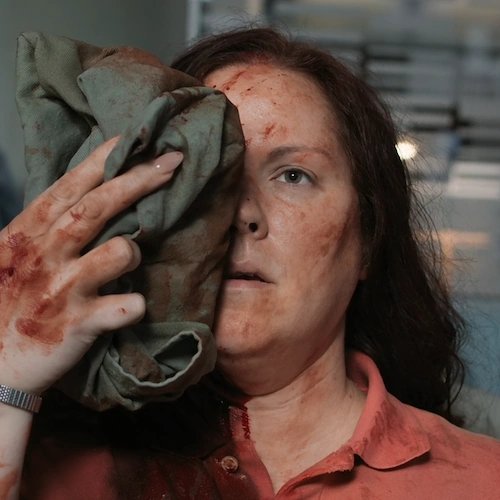 Arquivo:Mulher com trauma no olho T7E06 (TGD).png
