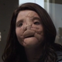 Molly em The Good Doctor: O Bom Doutor